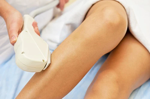 triệt lông vĩnh viễn thủ công